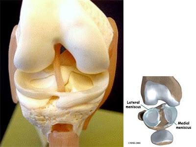 Does A Torn Meniscus Need Surgery : Check spelling or type a new query.