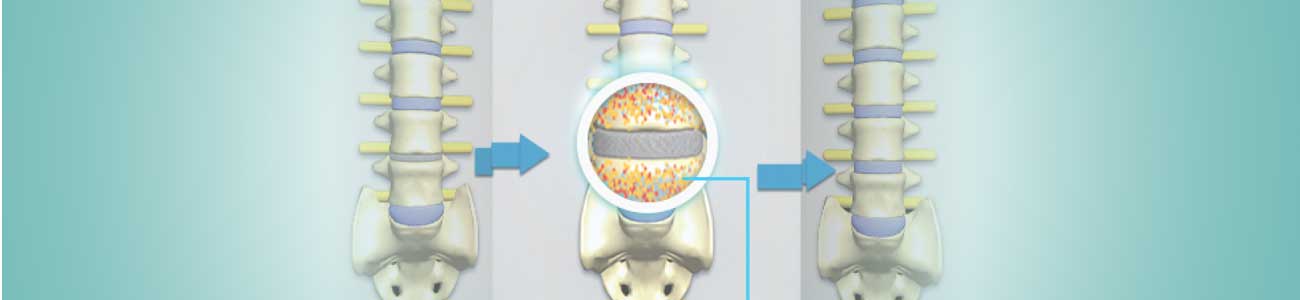 You are currently viewing Understand How a Disc Gets Damaged & Managed Safely