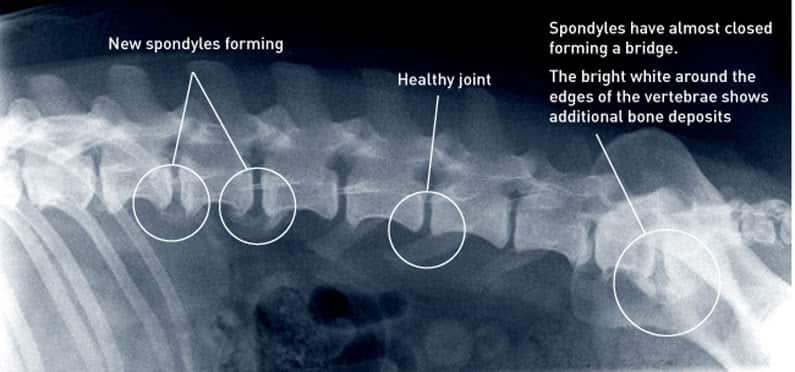 X-ray show healthy spine & spondylosis (bone spur)