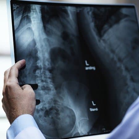Doctor holding spine x-ray