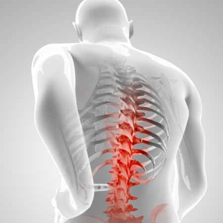 back pain illustration