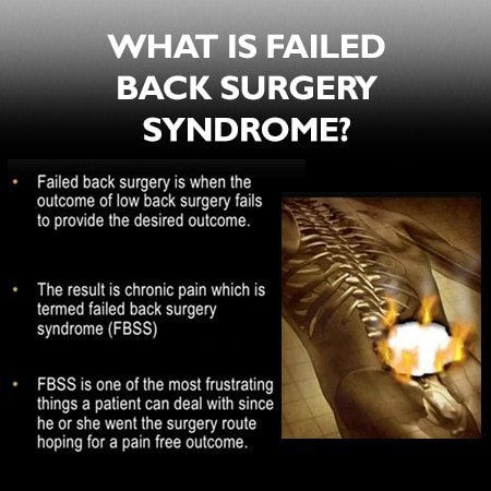Failed spine surgery definition infographic