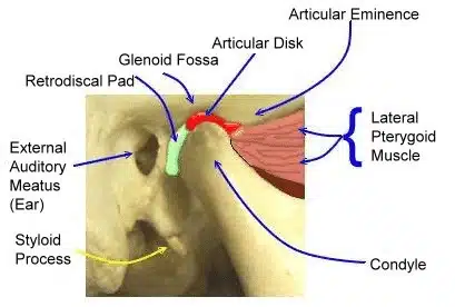 Jaw joint seen from the side on a skull: the articular disc sits between the condyle and the glenoid fossa, just in front of the ear canal