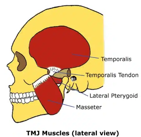 Side view of the skull showing the temporalis, masseter and lateral pterygoid muscles that move the jaw
