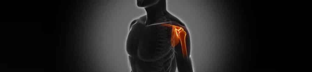 Illustration of joints and parts of shoulder involved in a frozen shoulder