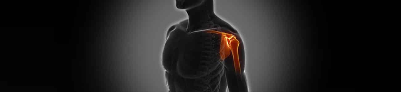 You are currently viewing Frozen Shoulder Care: Non-Invasive Options in Malaysia