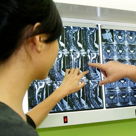 A professional chiropractor showing a female customer an MRI scan of her body where she is having issues.