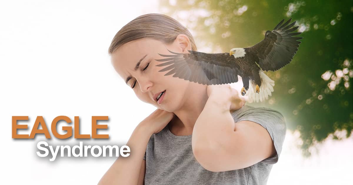 You are currently viewing What is Eagle Syndrome? Causes & Care Options