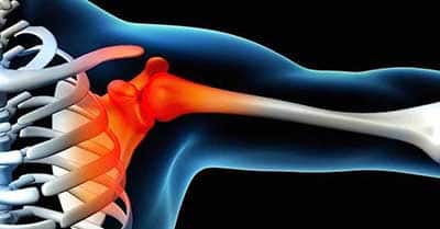 illustration of upper extremity pain and injury in Malaysia