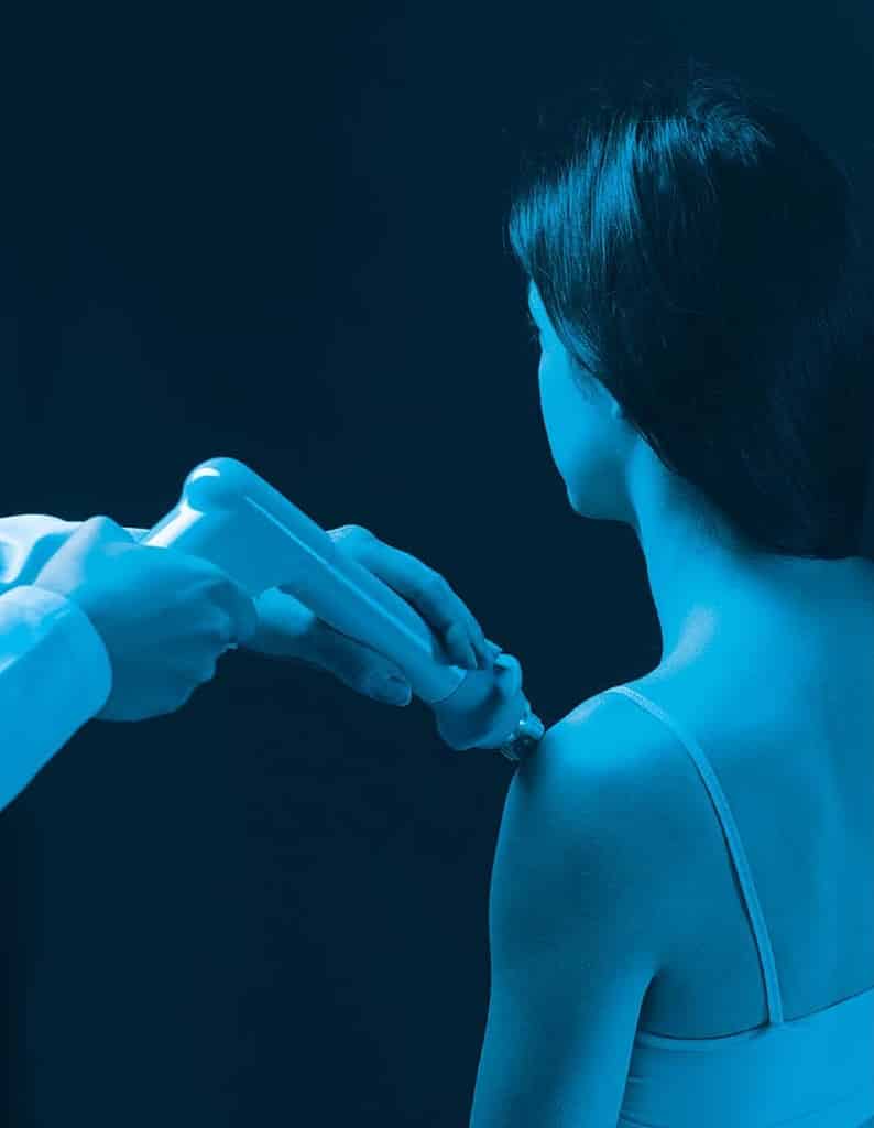 shockwave therapy of the left shoulder