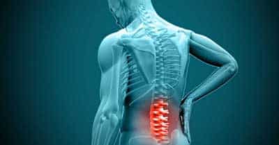 slipped disc and spondylosis in Kuala Lumpur, Malaysia