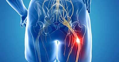 sciatica and spondylolisthesis pain in Malaysia