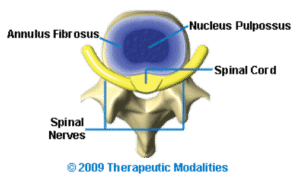 top view of the intervertebral disc