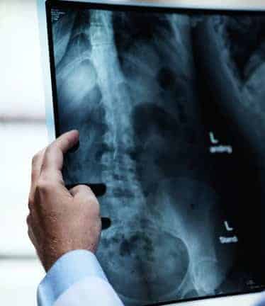 Setia Alam chiropractor assessing X-ray