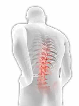 illustration of man with back pain due to slip disc