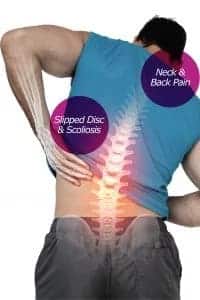 man with slip disc in neck & back shown