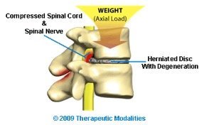 effects of axial load bearing shown