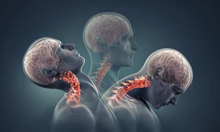 Neck Injury whiplash shown