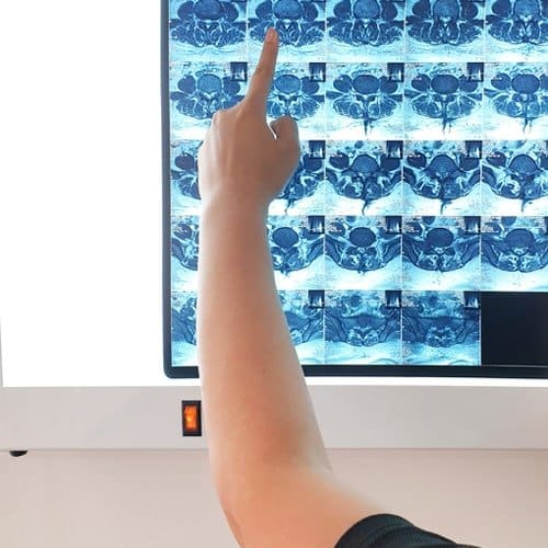 Chiropractor in sri petaling reviewing MRI fils