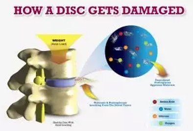 showing how a disc gets damaged
