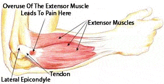 Illustration of elbow joint, muscles & ligaments