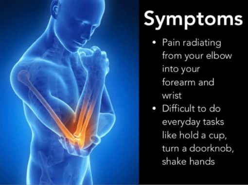 Illustration of a man with tennis elbow pain