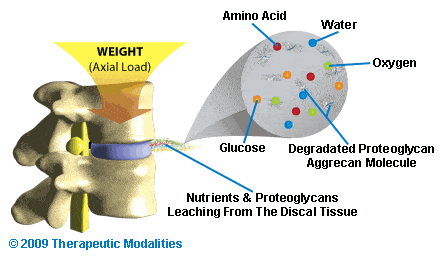 axial loading and its impact on disc degeneration