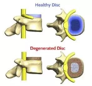 illustration of spinal bones