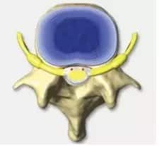 top view spinal disc
