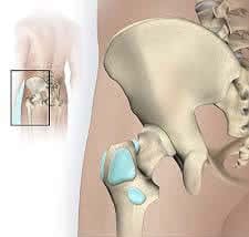 bursae of hip and hip joint