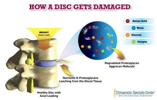 How a disc gets damages shown