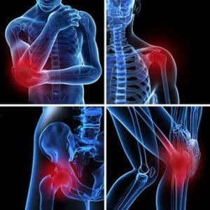 illustration of shoulder pain, elbow pain, hip pain & knee pain