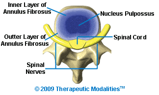 axial or top view of spinal disc