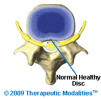 top view of a healthy normal spinal disc