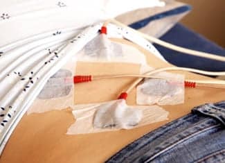 Interferential current therapy treatment