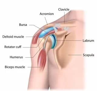 bursitis of the shoulder joint