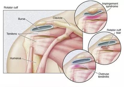 tendons of shoulder joint