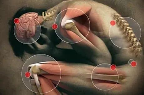 tendonitis in shoulder, hips, and knees shown