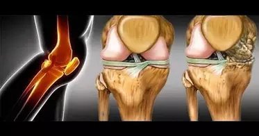 Anatomy of knee joint shown