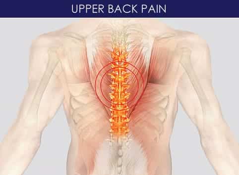 Target are for upper back pain treatment