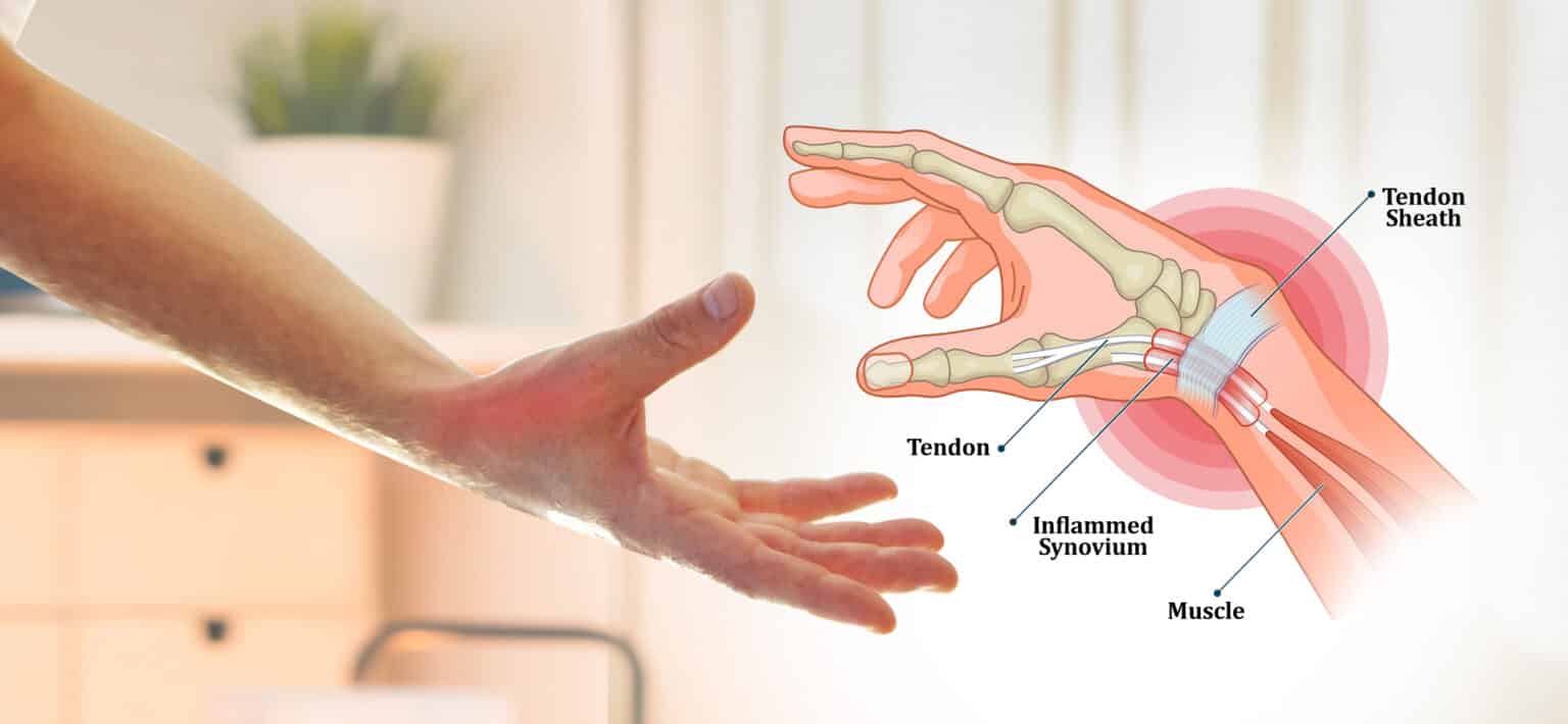 hand pain, wrist pain, thumb pain and de Quervain's tenosynovitis