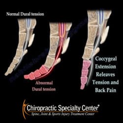 Coccydynia / Coccyx Pain / Tailbone Pain, a complete guide - Tuggeranong  Chiropractic Centre & Tuggeranong Therapeutic Massage