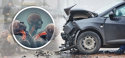 neck discomfort illustration and photo of neck injuries during a whiplash or car accident