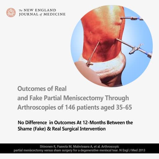 A picture showing  a kne ethat must have had surgery because there are rods inserted in the knee and there is a title at the bottom saying outcomes of real and fake partial Meniscectomy through Arthroscopies of 146 patients aged 35 - 65.