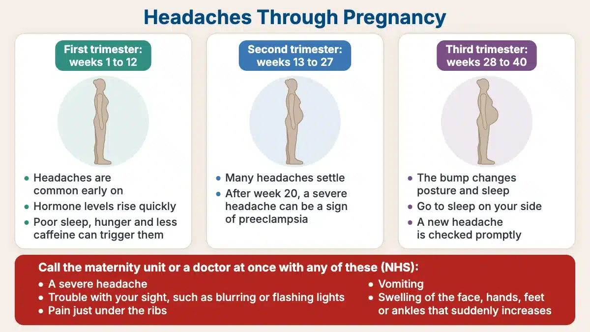 Pregnancy headache chart in three trimester panels: headaches are common early on, many settle in the second trimester, and after week 20 a severe headache can be a sign of preeclampsia; a red band lists the five NHS signs that need a call to the maternity unit or a doctor at once