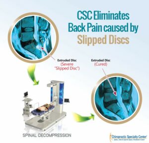 Infographic on effects of Spinal Decompression during back pain treatment