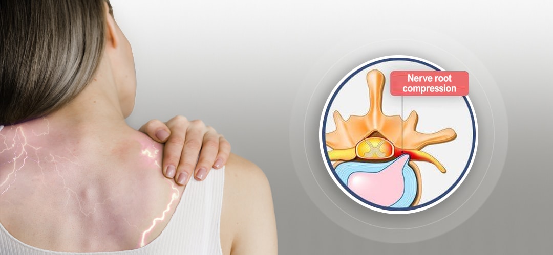 Read more about the article Pinched Nerve in KL – Numbness, Tingling & Nerve Pressure