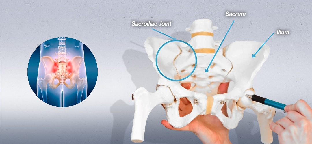 Read more about the article Sacroiliac Joint Care in KL – Gentle, Non-Invasive Methods