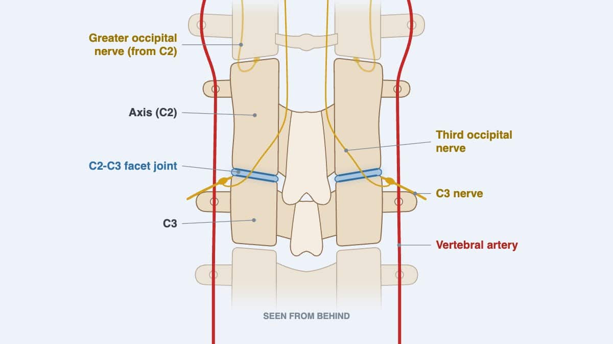 Read more about the article C2-C3 Nerve Compression & Facet Joint Symptoms: Care in KL