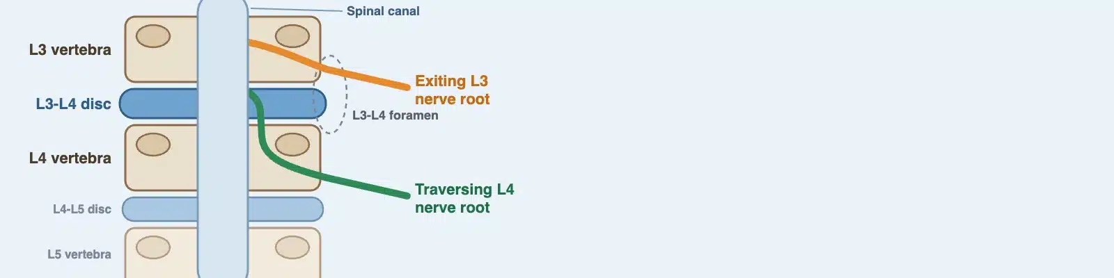 L3-L4 diagram, seen from behind: the L3 nerve root leaves through the L3-L4 foramen, and the L4 root passes the disc to leave one level lower